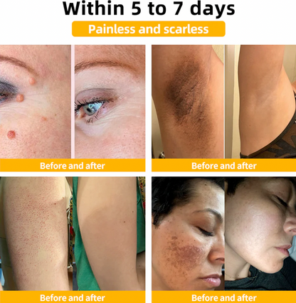 BeeLuxe™ Natural Lifting Cream